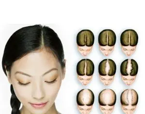 Dr. Felix Hair Implant – implant de par realizat pe baza tehnicii moderne Q-FUE