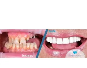 Servicii stomatologice complete la clinica stomatologica Dental Premier