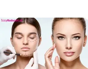 Rejuvenare faciala cu Botox, Acid Hialuronic si Fire PDO